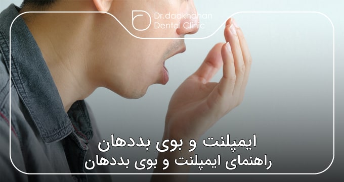 ایمپلنت و بوی بددهان