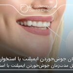 مدت‌زمان جوش‌خوردن ایمپلنت با استخوان فک ❤【سال1404】🦷