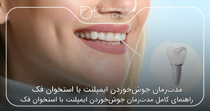 مدت‌زمان جوش‌خوردن ایمپلنت بااستخوان فک