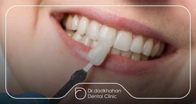روشهای جایگزین سیگار برای حفظ سلامت و زیبایی دندانها