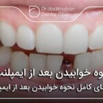 نحوه خوابیدن بعد از ایمپلنت✅【سال1404】🦷