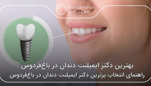 بهترین دکتر ایمپلنت دندان در باغ‌فردوس