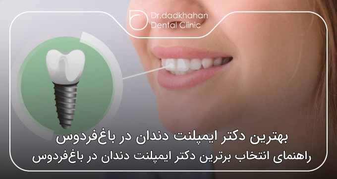 بهترین دکتر ایمپلنت دندان در باغ‌فردوس