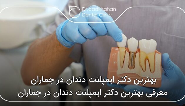 بهترین دکتر ایمپلنت دندان در جماران