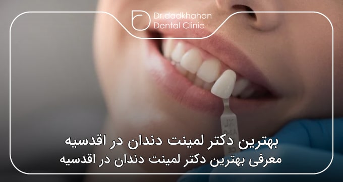 بهترین دکتر لمینت دندان در اقدسیه