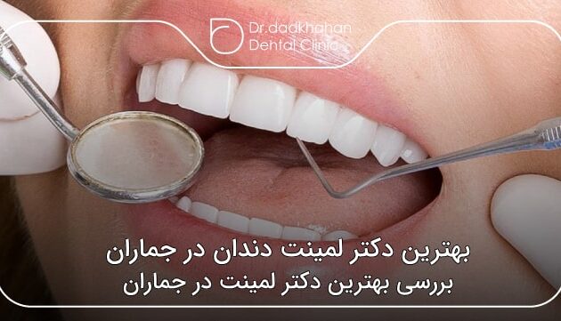 بهترین دکتر لمینت دندان در جماران