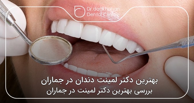 بهترین دکتر لمینت دندان در جماران