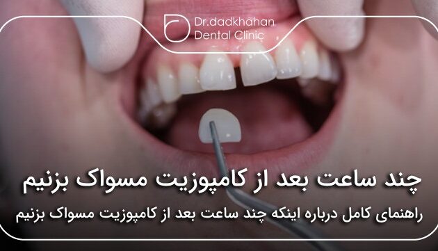 چند ساعت بعد از کامپوزیت مسواک بزنیم✅【سال1404】🦷
