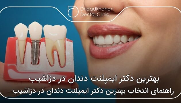 بهترین دکتر ایمپلنت دندان در دزاشیب