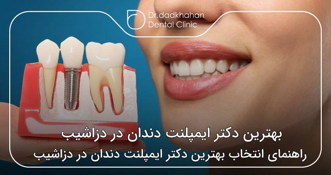بهترین دکتر ایمپلنت دندان در دزاشیب