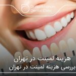 هزینه لمینت در تهران 🦷【سال1404】❤