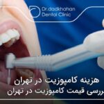 هزینه کامپوزیت در تهران 🦷【سال1404】✔
