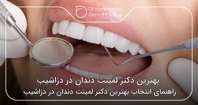 بهترین دکتر لمینت دندان در دزاشیب