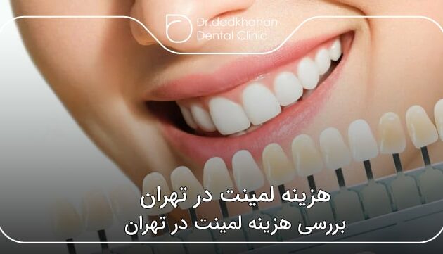 هزینه لمینت در تهران