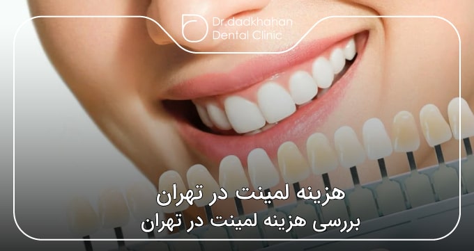 هزینه لمینت در تهران