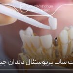 ایمپلنت ساب پریوستئال دندان چیست؟ ✅【سال1404】🦷