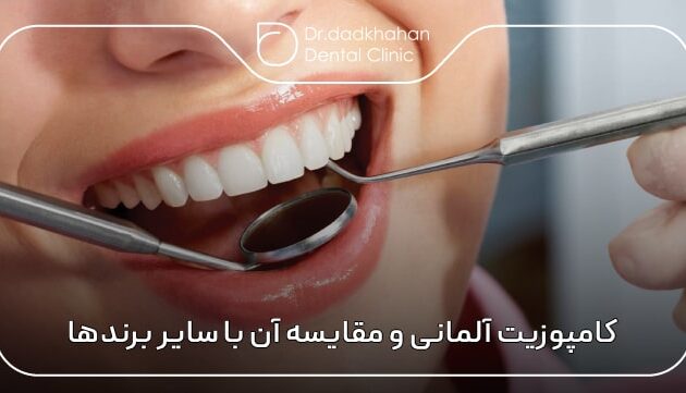کامپوزیت آلمانی و مقایسه آن با سایر برندهای مطرح جهان