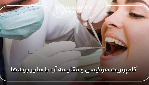 کامپوزیت سوئیسی و مقایسه آن با سایر برندهای پرطرف‌دار جهانی