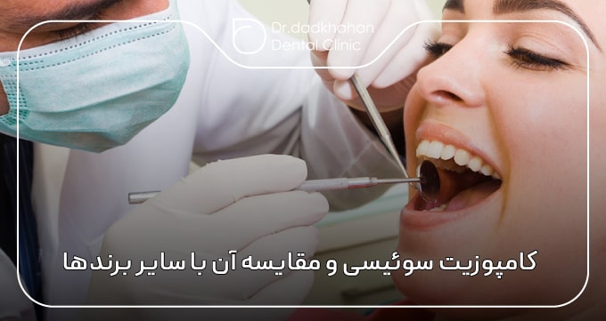 کامپوزیت سوئیسی و مقایسه آن با سایر برندهای پرطرف‌دار جهانی