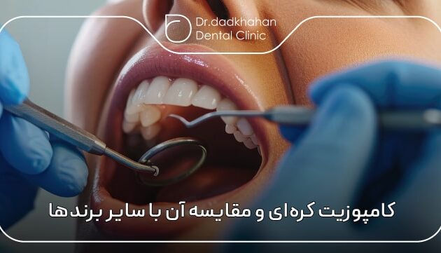کامپوزیت کره‌ای و مقایسه آن با سایر برندهای پرطرف‌دار جهانی