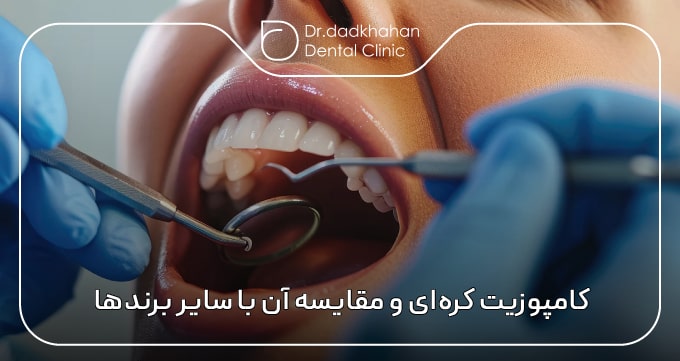 کامپوزیت کره‌ای و مقایسه آن با سایر برندهای پرطرف‌دار جهانی