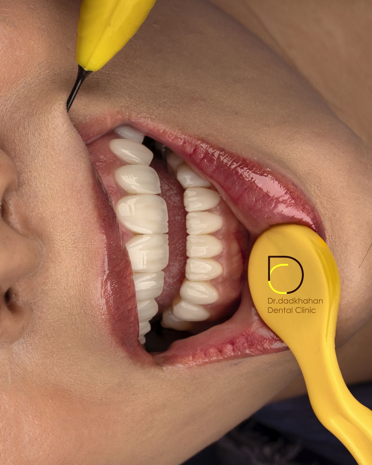 نمونه کار دکتر دادخواهان (8)