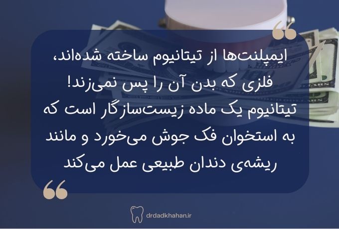 نکته ایمپلنت دندان