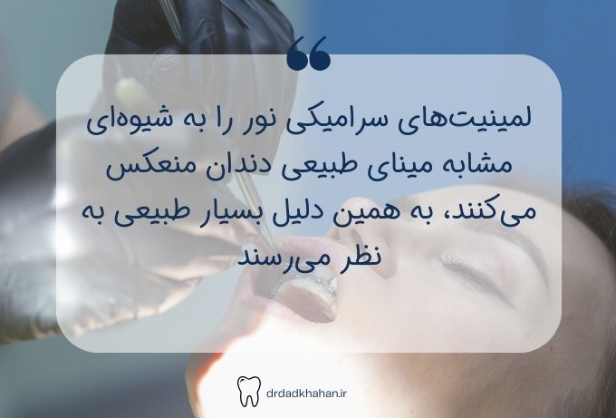 نکته لمینت دندان 