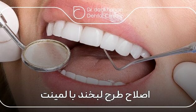 اصلاح طرح لبخند با لمینت