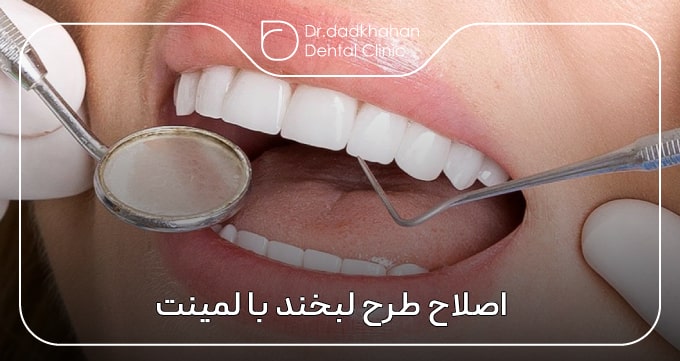 اصلاح طرح لبخند با لمینت