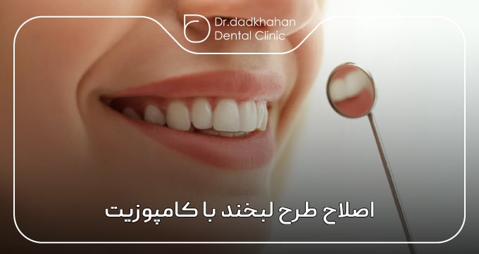 اصلاح طرح لبخند با کامپوزیت