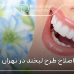 اصلاح طرح لبخند در تهران ⚡【سال1404】🦷