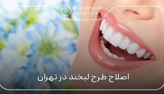 اصلاح طرح لبخند در تهران