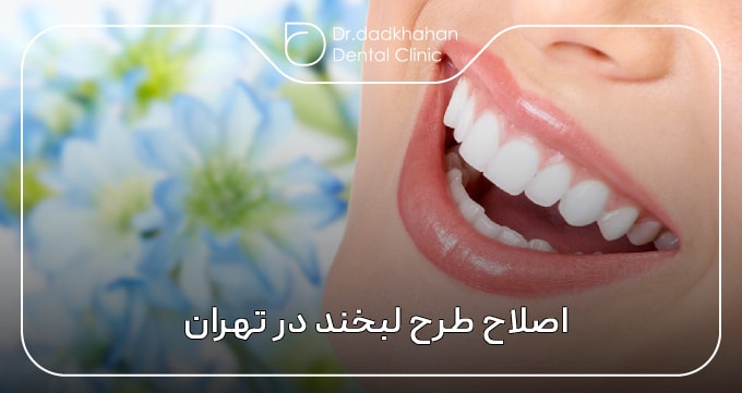 اصلاح طرح لبخند در تهران
