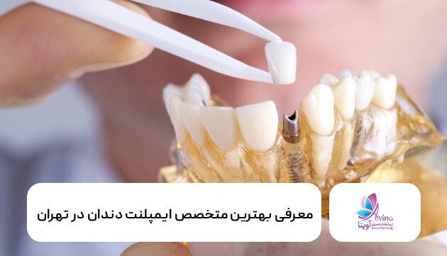 بهترین متخصص ایمپلنت دندان در تهران