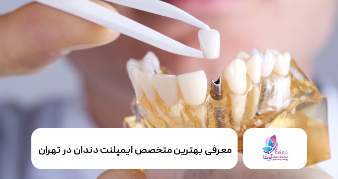 بهترین متخصص ایمپلنت دندان در تهران