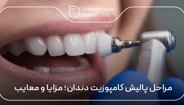 مراحل پالیش کامپوزیت دندان؛ مزایا و معایب