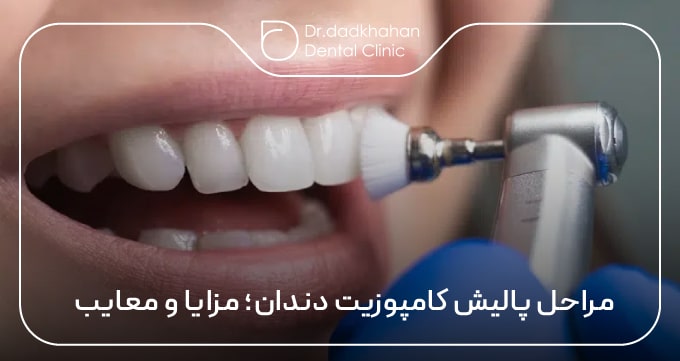 مراحل پالیش کامپوزیت دندان؛ مزایا و معایب