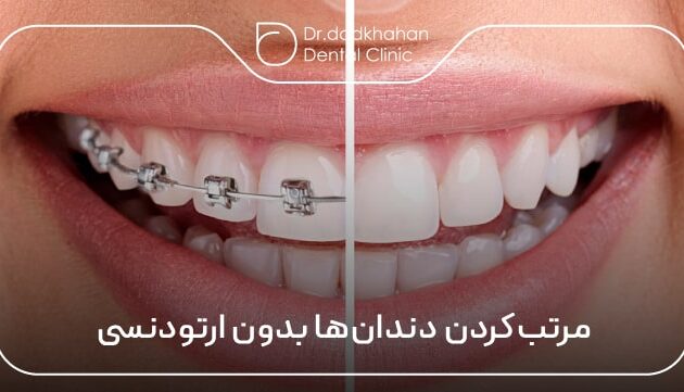 مرتب‌کردن دندان‌ها بدون ارتودنسی