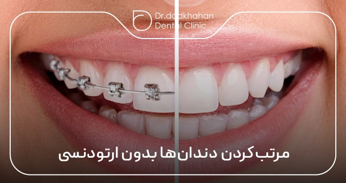 مرتب‌کردن دندان‌ها بدون ارتودنسی