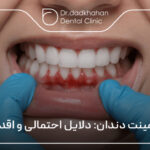 افتادن لمینت دندان: دلایل احتمالی و اقدام فوری 🦷