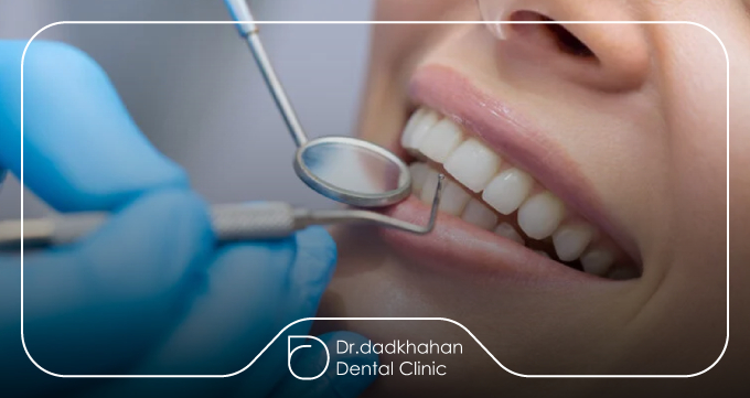 روش‌های پیشگیری از آسیب لمینت ناشی از دندان قروچه