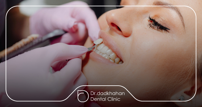 لبپریدگی و شکستگی دندان چیست؟