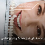 آیا لمینت دندان نیاز به نگهداری خاصی دارد؟ ⚡【سال1404】🦷