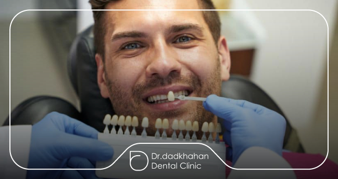 لمینت سرامیکی Ceramill / Cercon