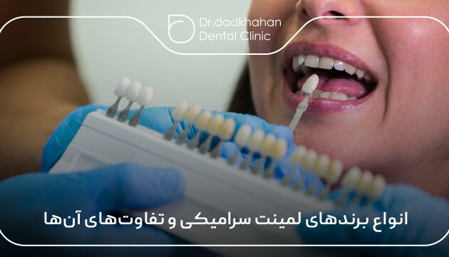 انواع برندهای لمینت سرامیکی و تفاوت‌های آن‌ها