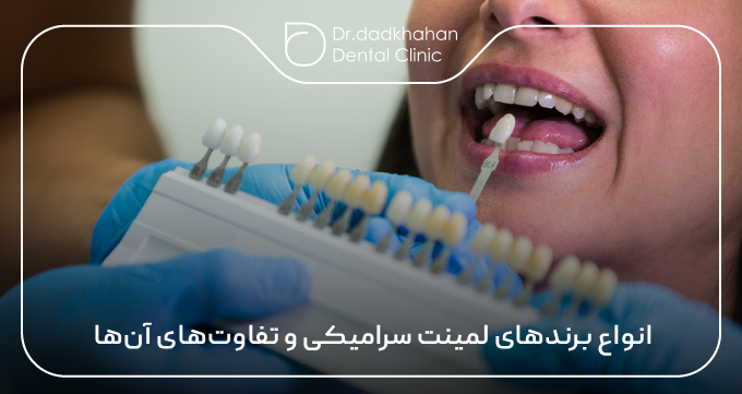 انواع برندهای لمینت سرامیکی و تفاوت‌های آن‌ها