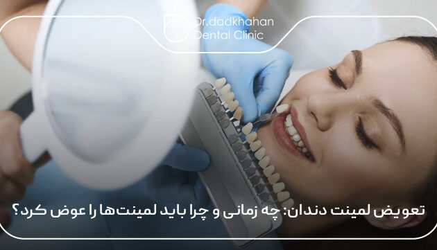 تعویض لمینت دندان: چه زمانی و چرا باید لمینت‌ها را عوض کرد؟