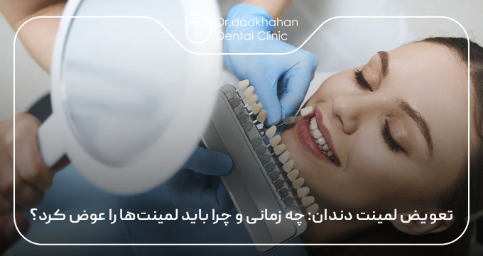 تعویض لمینت دندان: چه زمانی و چرا باید لمینت‌ها را عوض کرد؟