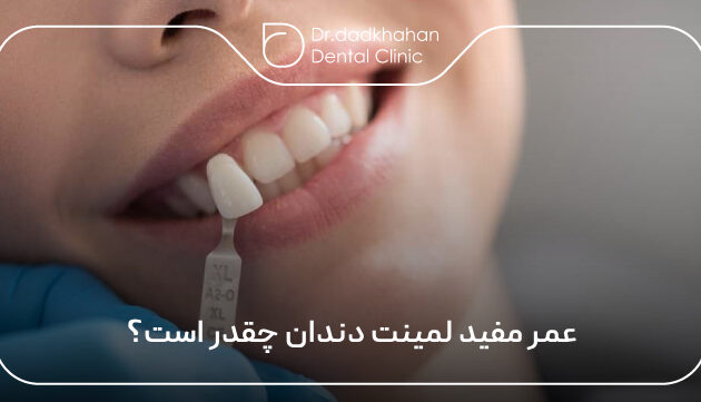 عمر مفید لمینت دندان چقدر است؟